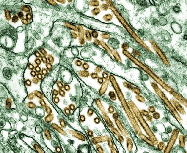 An electron micrograph of the H5N1 bird flu virus